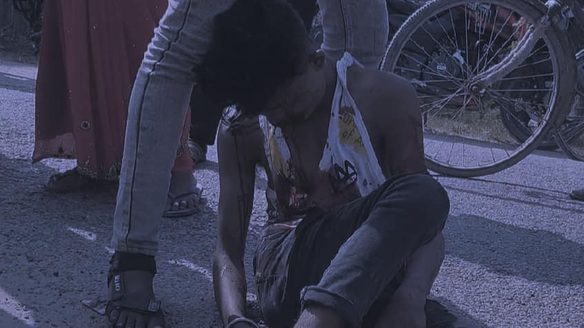 मिचैयामा मोटरसाइकल दुर्घटना हुँदा एक जनाको ज्यान गयो भने अर्का एक जना गम्भिर घाइते